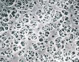 CA membrane filter